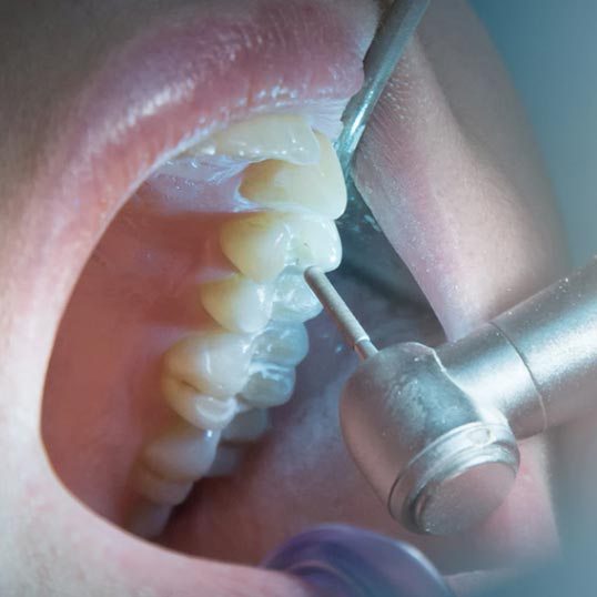 Endodontics Practice Marketing