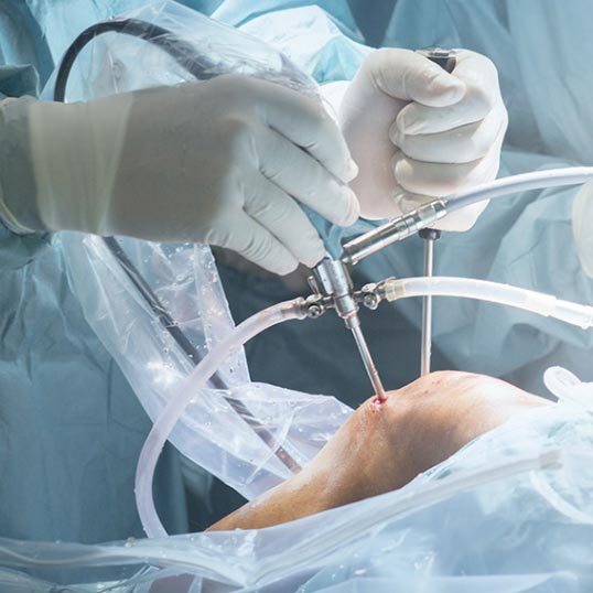 Orthopedic Surgery Marketing