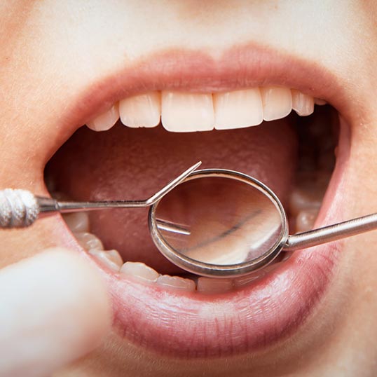Periodontics Marketing Services