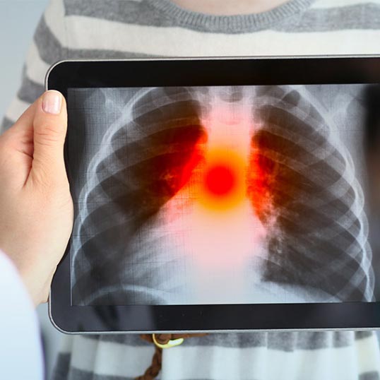 Pulmonology Marketing Services